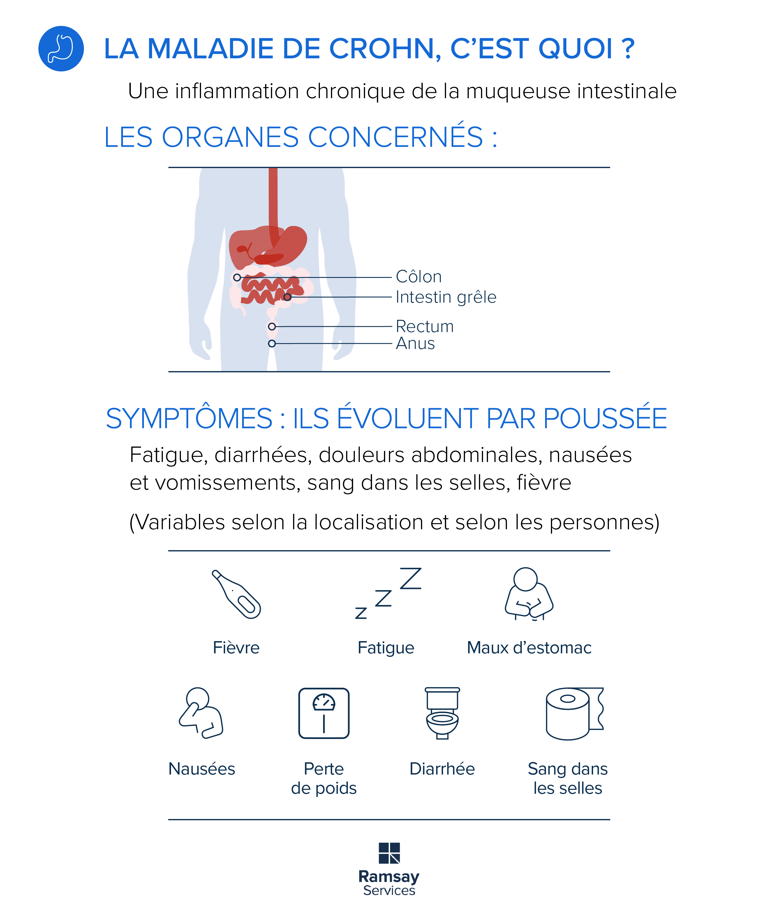 La maladie de Crohn