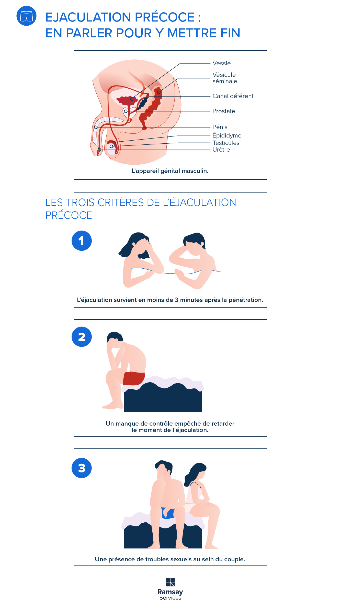 Ejaculation précoce