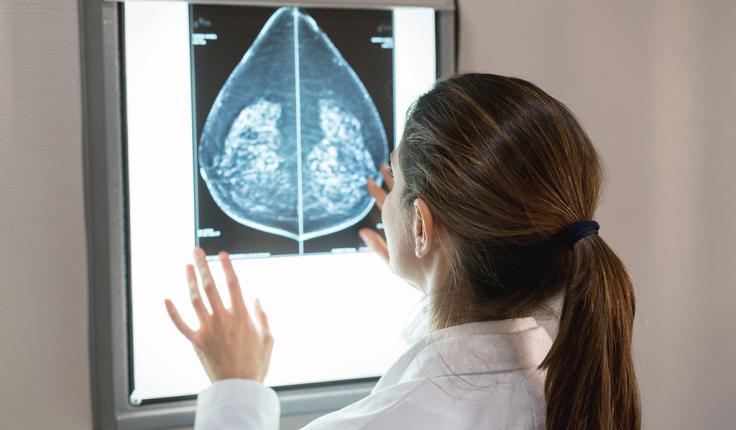 Dépistage du cancer du sein : pourquoi et quand le faire ?