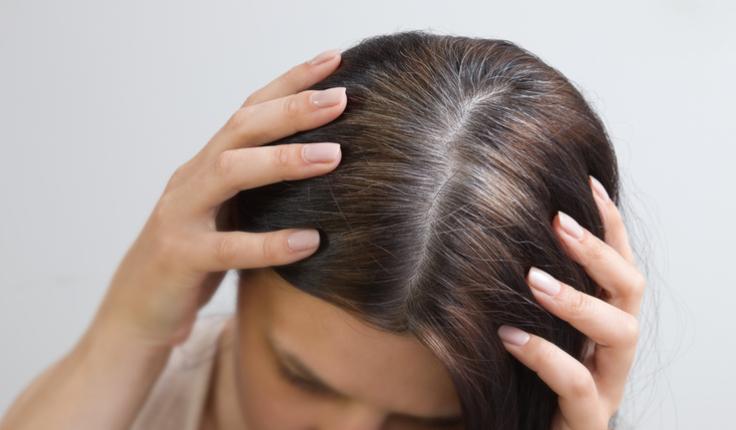 cheveux blancs stress.jpg