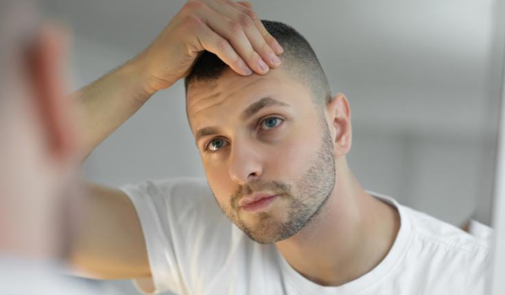 perte cheveux chute.jpg