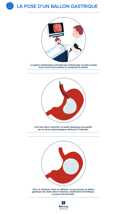 infog-obésité