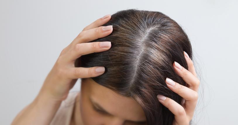 cheveux blancs stress.jpg