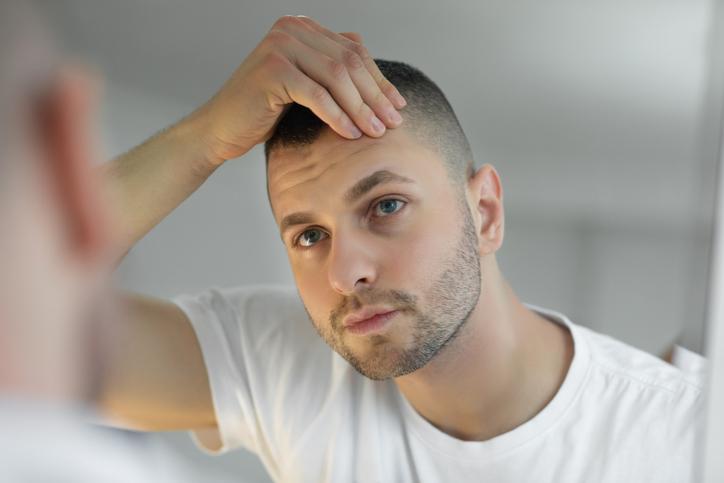 perte cheveux chute.jpg