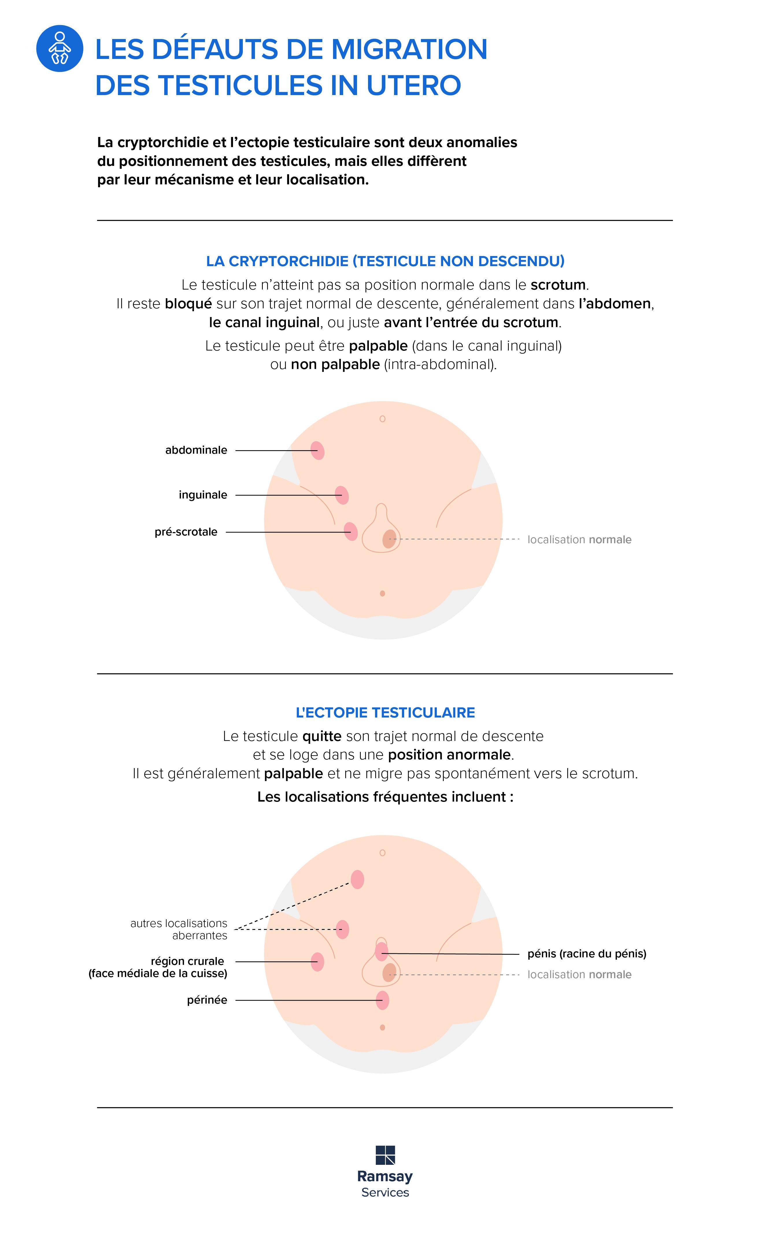 testicule non descendu